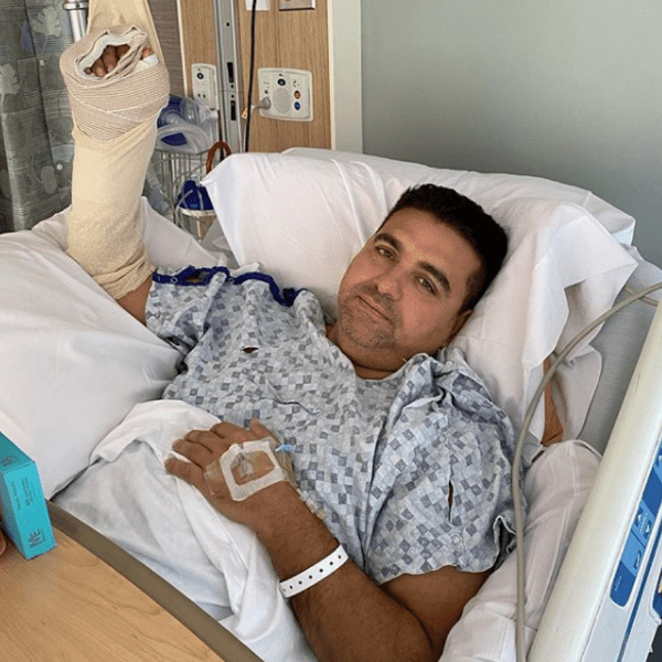 Buddy Valastro conta detalhes de acidente: 'Levou metade da minha mão'