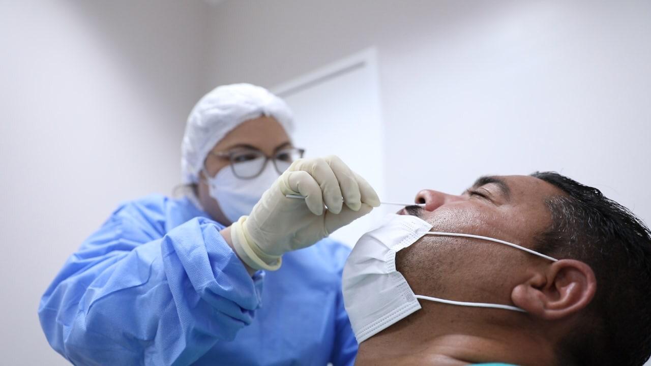 Estado revela queda na positividade de casos de Covid-19