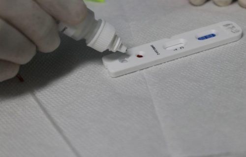 Nota Técnica da FVS-RCP restringe Teste Rápido de Anticorpos a diagnóstico de SIM-P