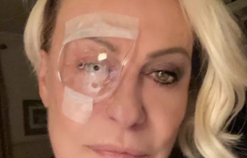 Ana Maria Braga aparece de tapa-olho após cirurgia