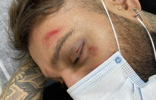 Lucas Lucco aparece no hospital machucado e com dedo luxado