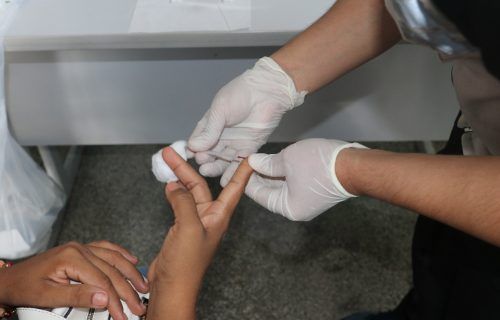 Saúde lança programação de prevenção e combate ao HIV/Aids no AM