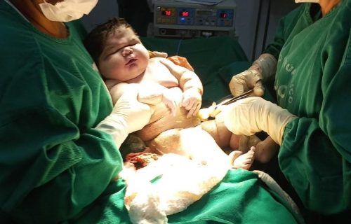Maternidade de Parintins registra o nascimento do maior bebê do Amazonas