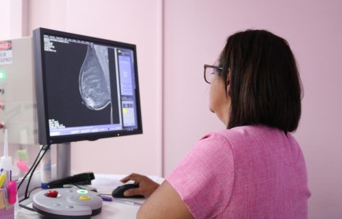 fcecon-mamografia-foto-lais-pompeu-1