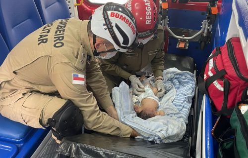 cbmam-2_recem-nascido