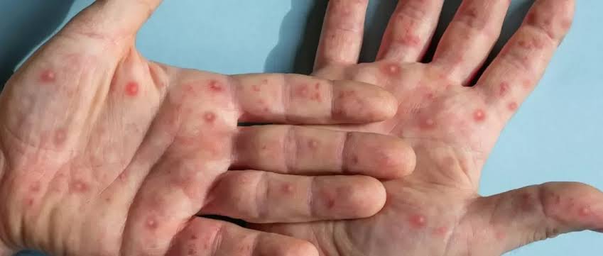 images-2025-05-01t062448-179