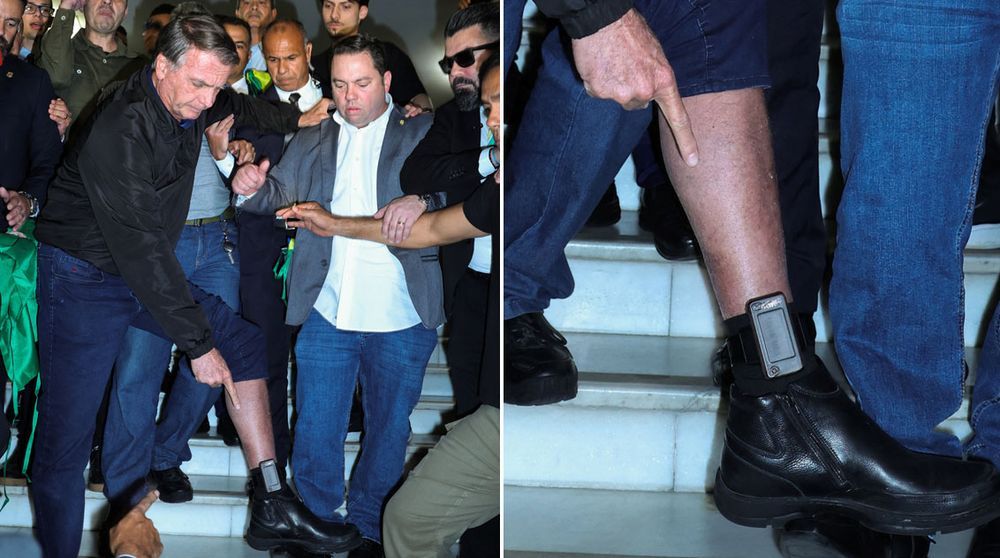 bolsonaro-tornozeleira-foto-02