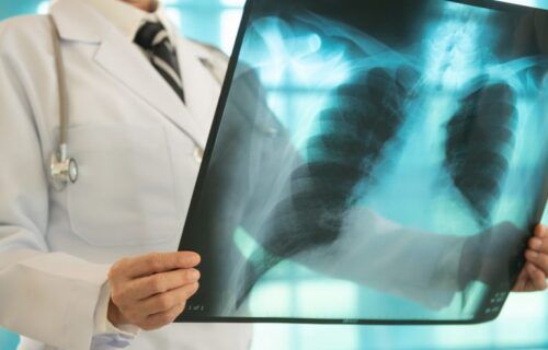 gettyimages-1472917690-768x533