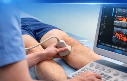 release-da-sbacvsp-embolia-divulgacao-24-2