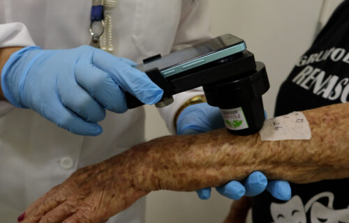 FUnATI lança serviço de TeleDermatologia em parceria com a UFSC
